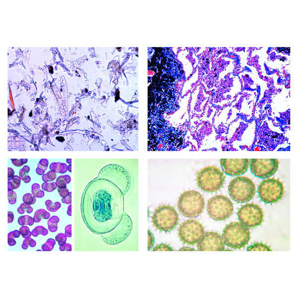 LIEDER Environment IV. Air Pollution and Allergens, 15 microscope slides