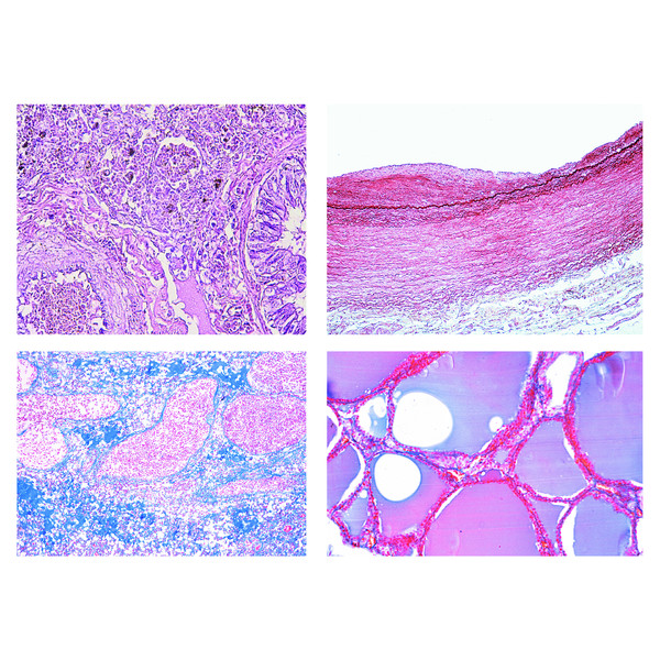 LIEDER Histologie pathologie humaine, petite série (50 préparations)