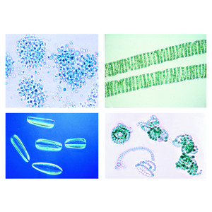 LIEDER Environment, II. Water Pollution. Problems and Results, 20 microscope slides