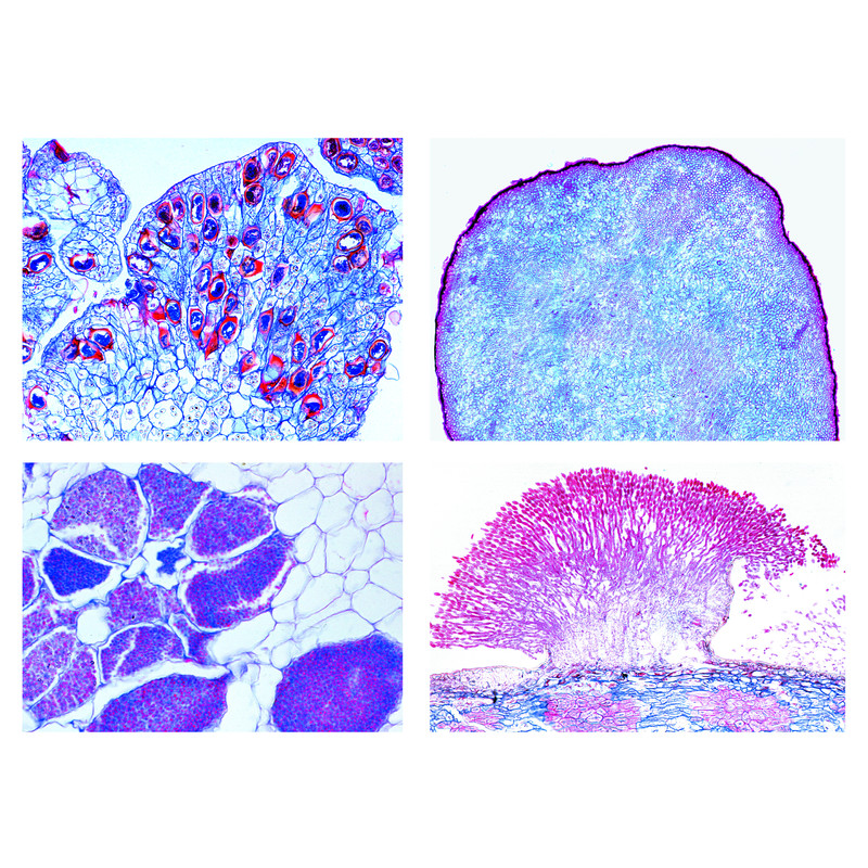 LIEDER Agriculture (Parasitic Fungi), 20 microscope slides