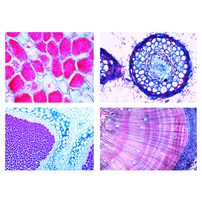 LIEDER Agriculture and Forestry, Part III. Animal pests, symbiosis and soil life, 24 prepared microscope slides